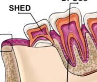 The Role of Stem Cells in Regenerative Medicine, Their Applications in Dentistry and Orthodontics