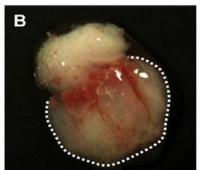 Stem Cell Usage in Dentistry: A Promising Future 